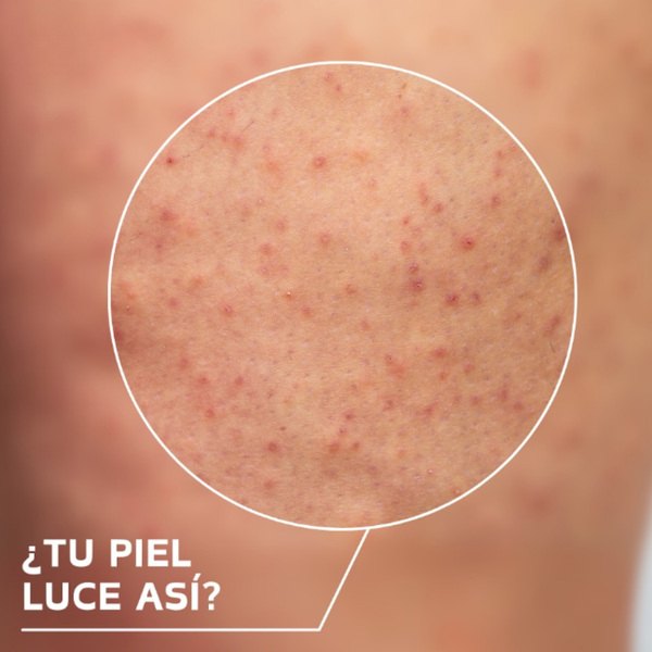 Crema Depilatoria Suave y Efectiva
