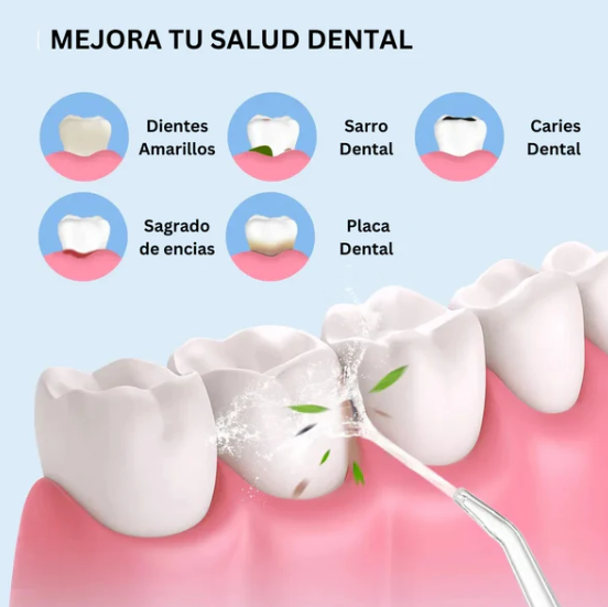 Irrigador Bucal ProSmart Anti-Sarro (Recargable)