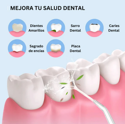 Irrigador Bucal ProSmart Anti-Sarro (Recargable)