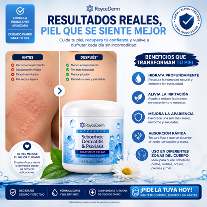 RoyceDerm Crema para Dermatitis Seborreica y Psoriasis