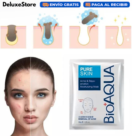 Mascariila Anti Acné Bioaqua (5 Mascarillas)