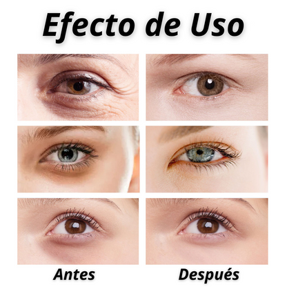 Parches de Mascarilla Soluble de Colágeno Hidrolizado (Incluye Spray de Colágeno)