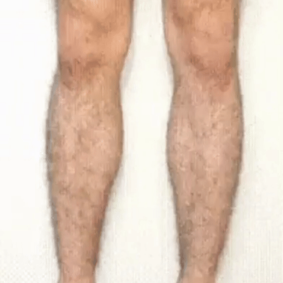 Crema Depilatoria Suave y Efectiva