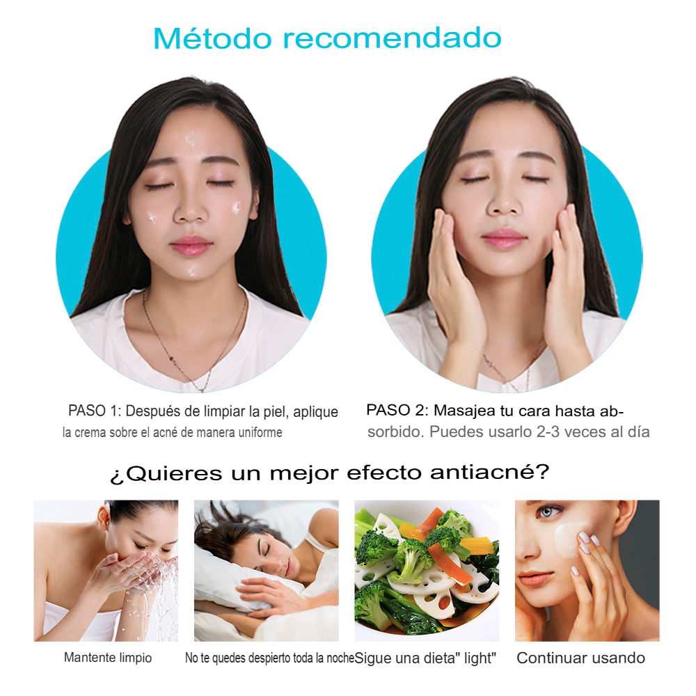 (2x1) Crema Anti Acné "Bioaqua" Lleva 2 Cremas